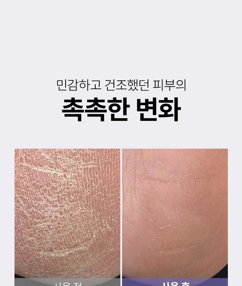[대용량] 위드샨 네일&큐티클 오일펜 올케어 세트 (4ml x 4ea) 상세페이지 46